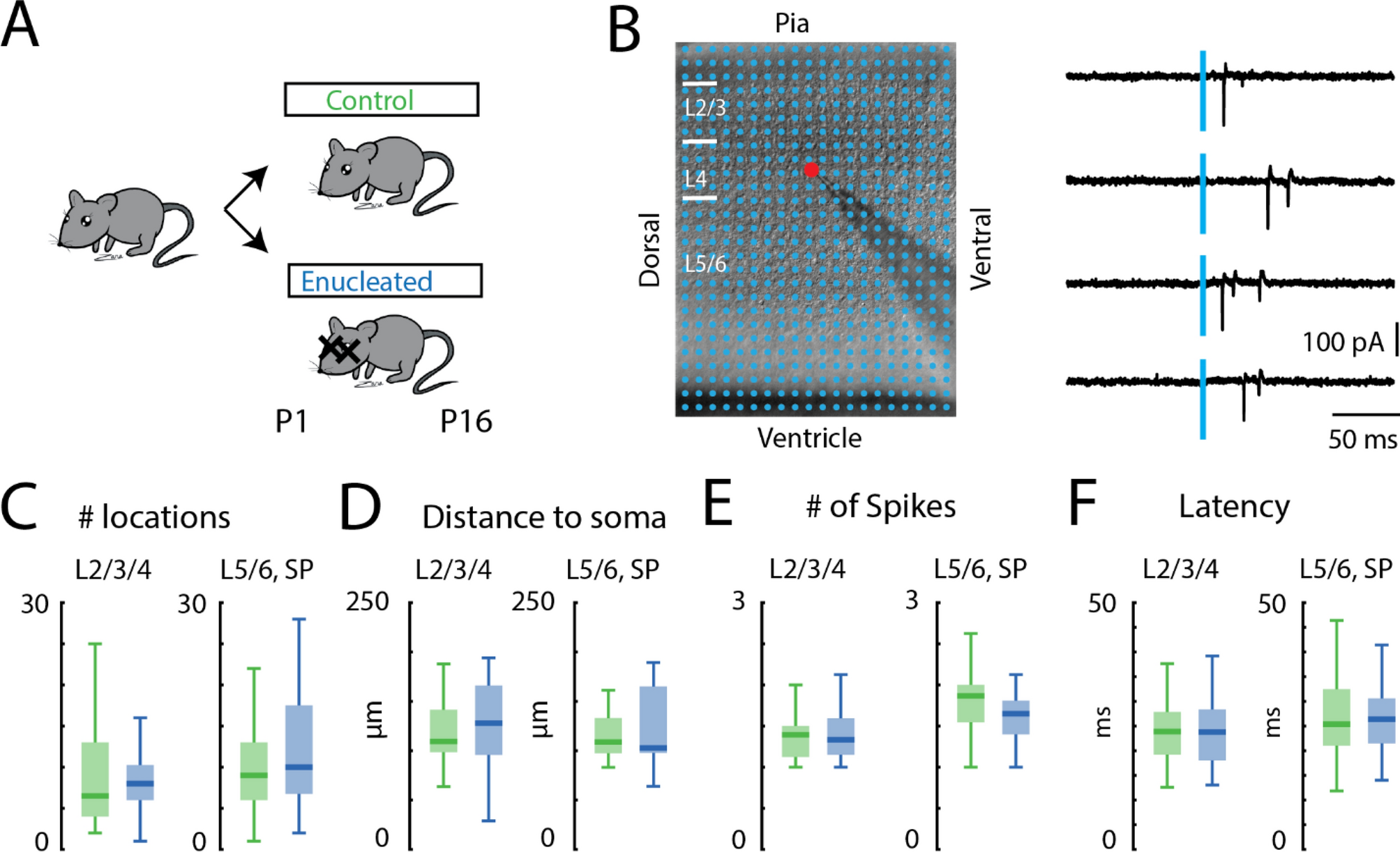 Aberrant inhibitory processing in the somatosensory cortices of