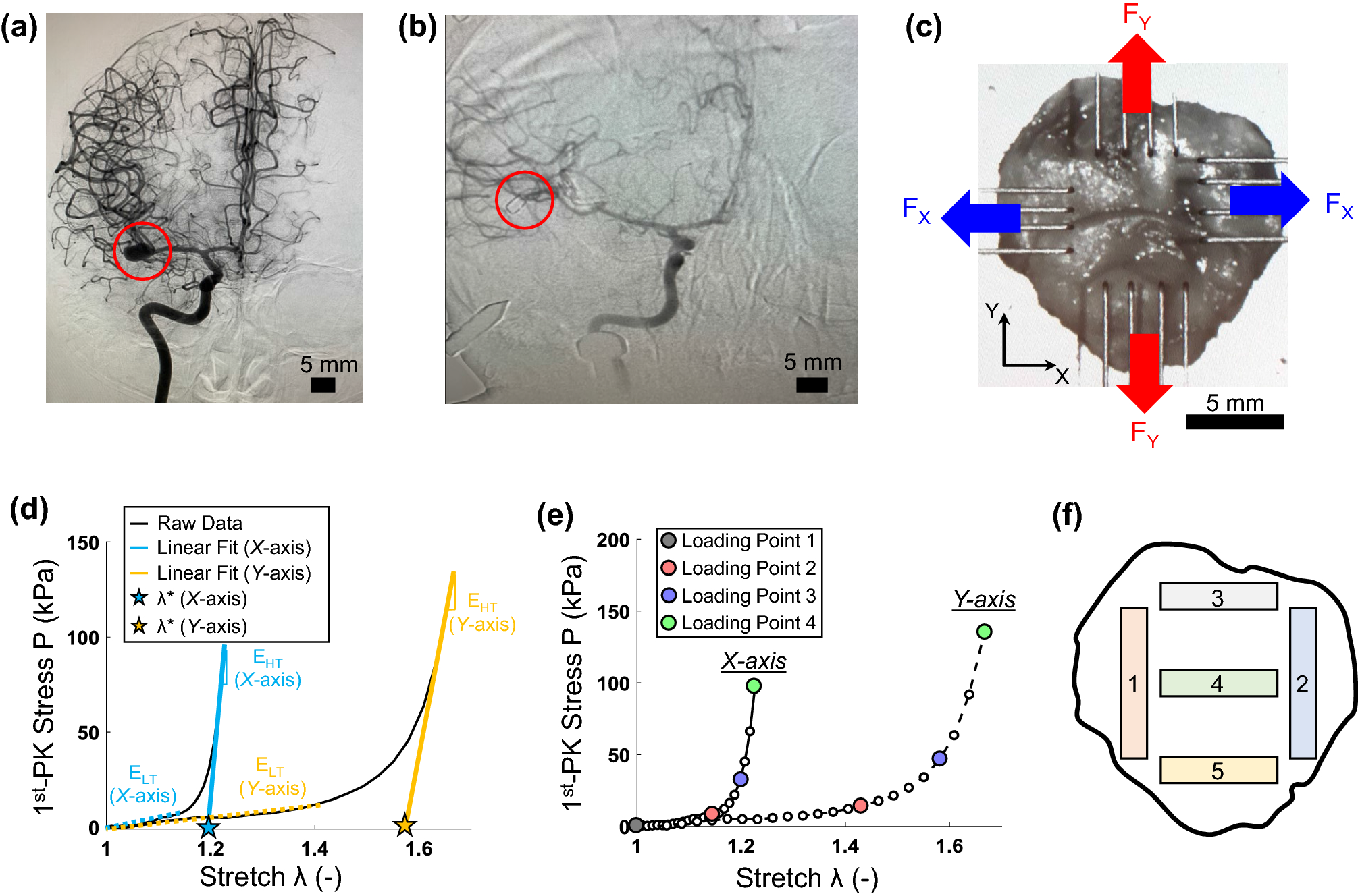 A Pilot Study On Biaxial Mechanical Collagen Microstructural And Morphological Characterizations Of A Resected Human Intracranial Aneurysm Tissue Scientific Reports