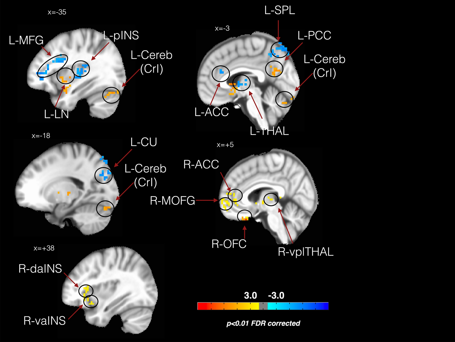 Osteopathy Modulates Brain Heart Interaction In Chronic Pain Patients An Asl Study Scientific Reports Osteopathy Modulates Brain Heart Interaction In Chronic Pain Patients An Asl Study Scientific Reports