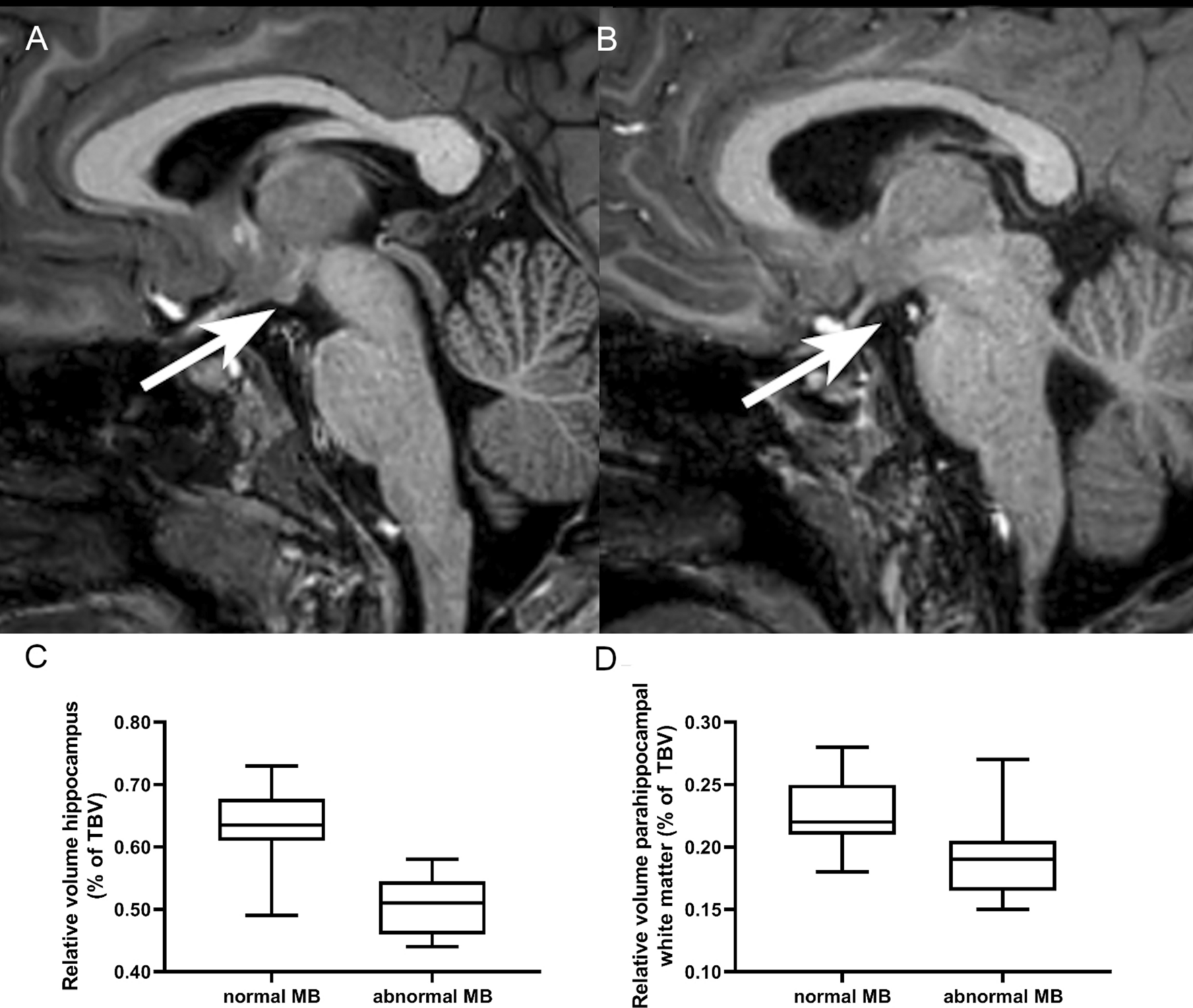 Mammillary body atrophy and other MRI correlates of school-age 