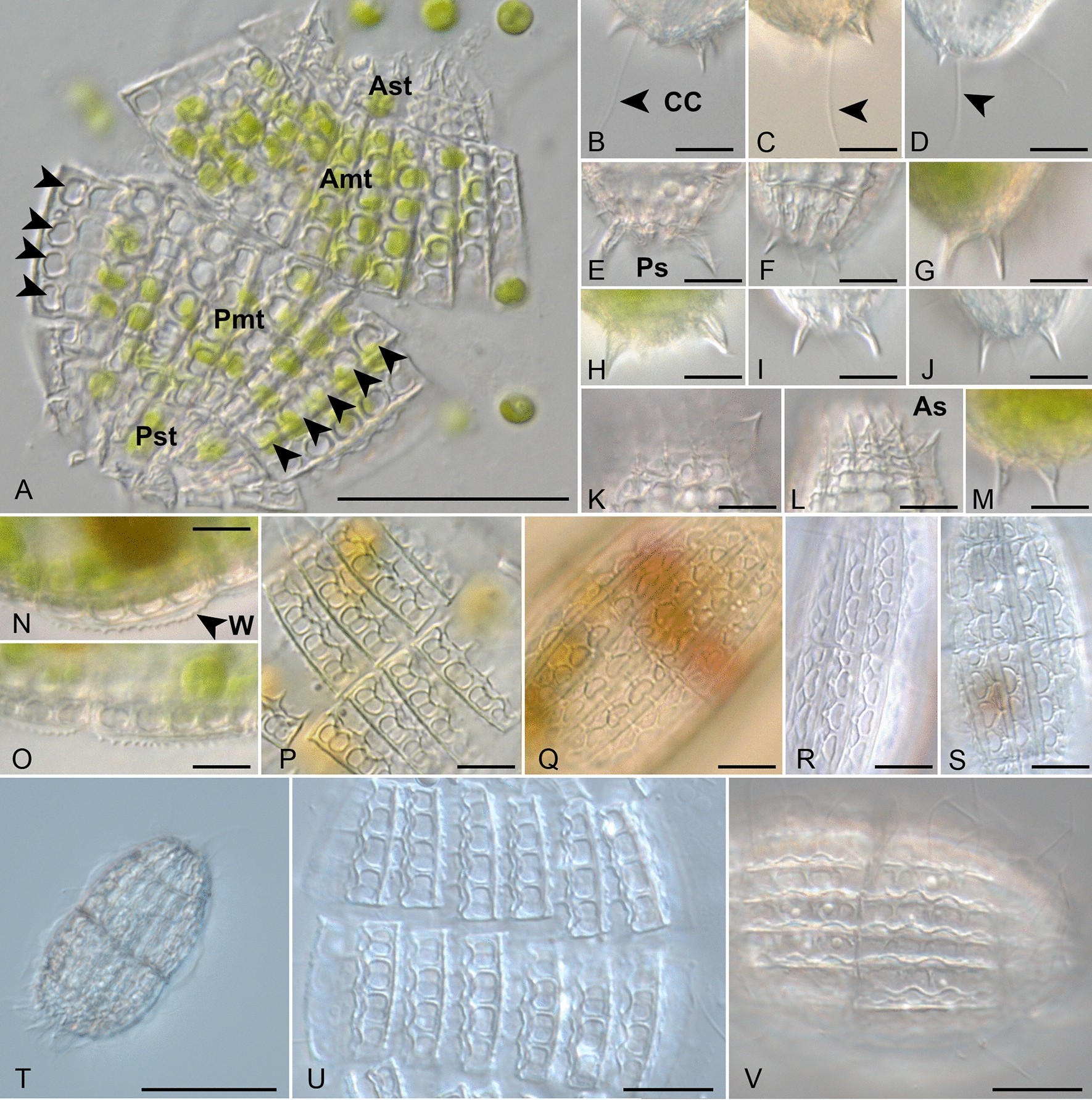 An integrative approach sheds new light onto the systematics and ecology of  the widespread ciliate genus Coleps (Ciliophora, Prostomatea) | Scientific  Reports