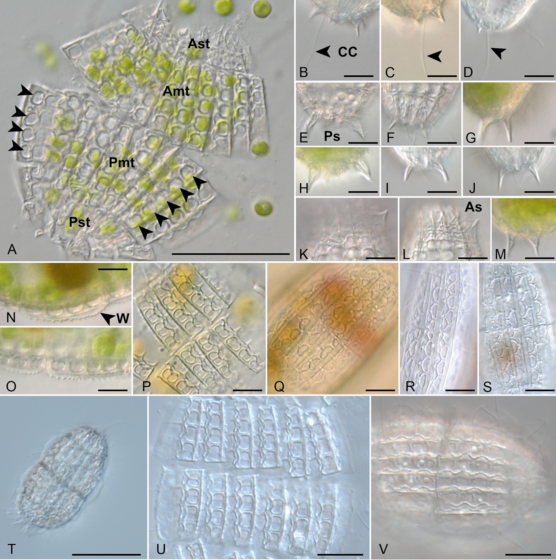 ciliates under microscope