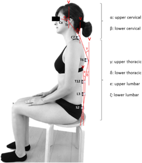 Lower spinal postural variability during laptop-work in subjects