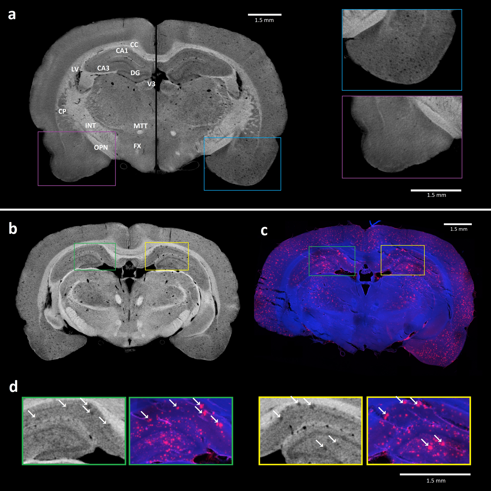 Contrast enhanced X-ray computed tomography imaging of amyloid plaques in  Alzheimer disease rat model on lab based micro CT system | Scientific  Reports