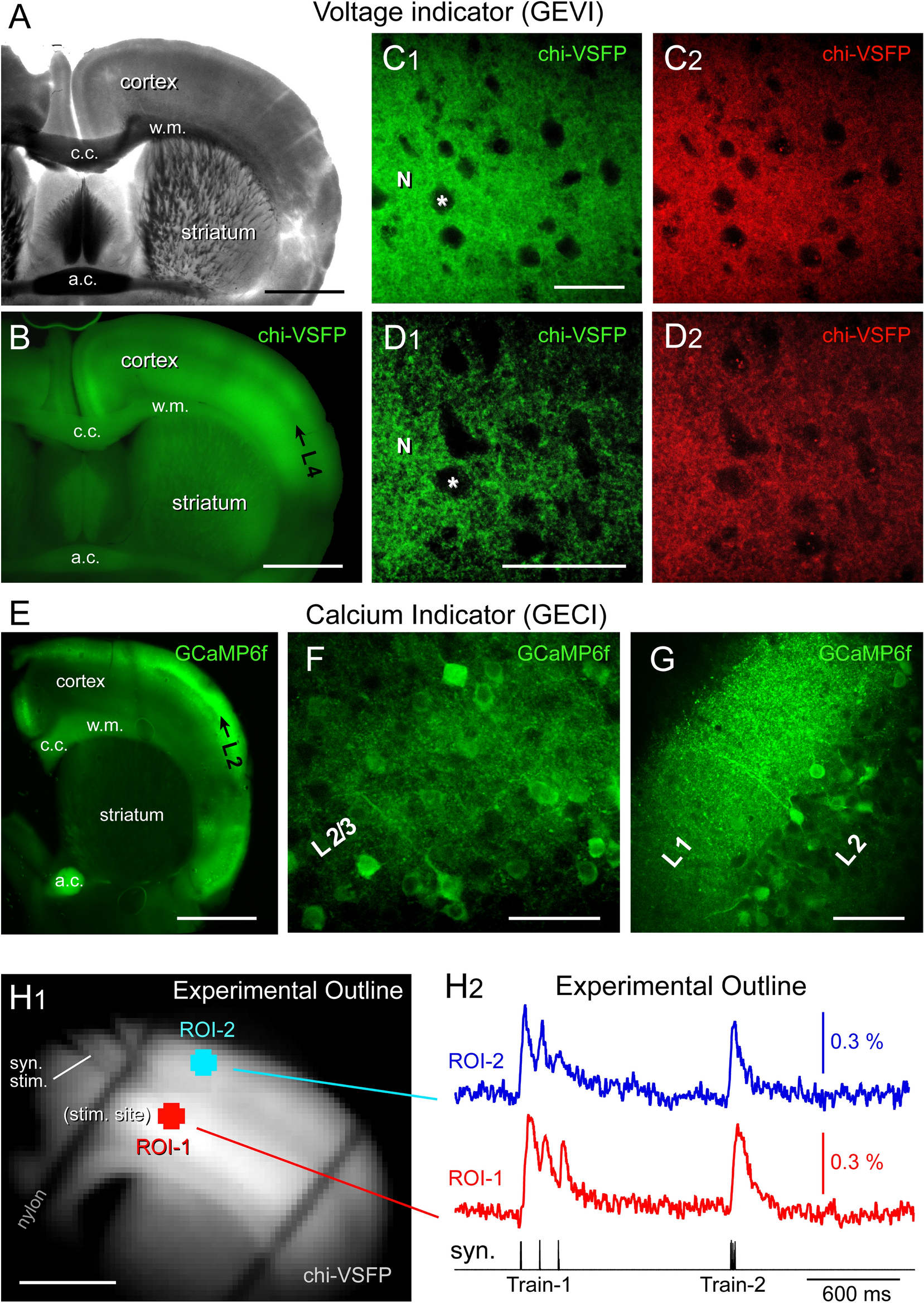 Population imaging discrepancies between a genetically-encoded calcium  indicator (GECI) versus a genetically-encoded voltage indicator (GEVI) |  Scientific Reports