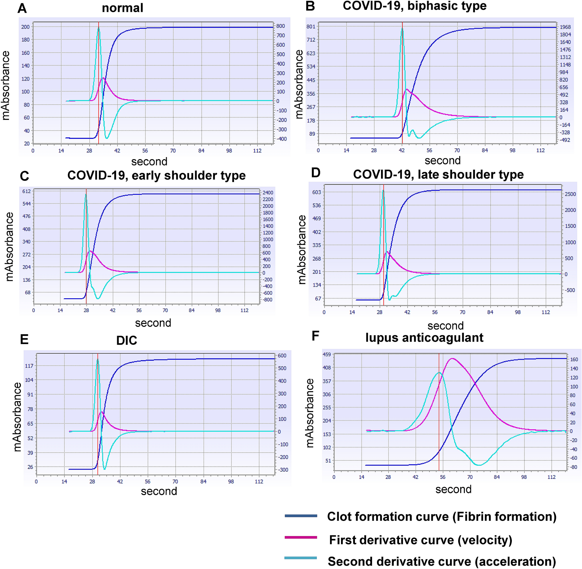 Clot Waveform Of Aptt Has Abnormal Patterns In Subjects With Covid 19 Scientific Reports