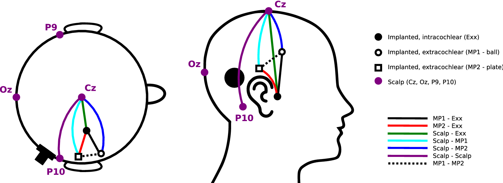 Eeg Based Diagnostics Of The Auditory System Using Cochlear Implant Electrodes As Sensors Scientific Reports Eeg Based Diagnostics Of The Auditory System Using Cochlear Implant Electrodes As Sensors Scientific Reports