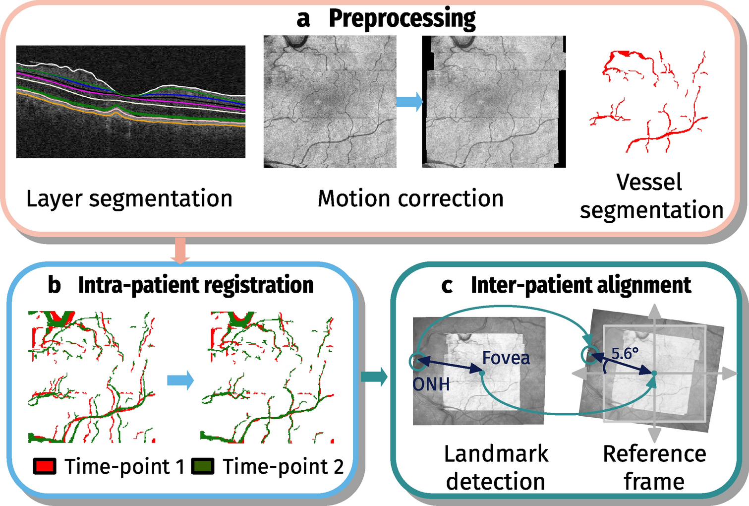 Layers of the Retina - Discovery Eye Foundation