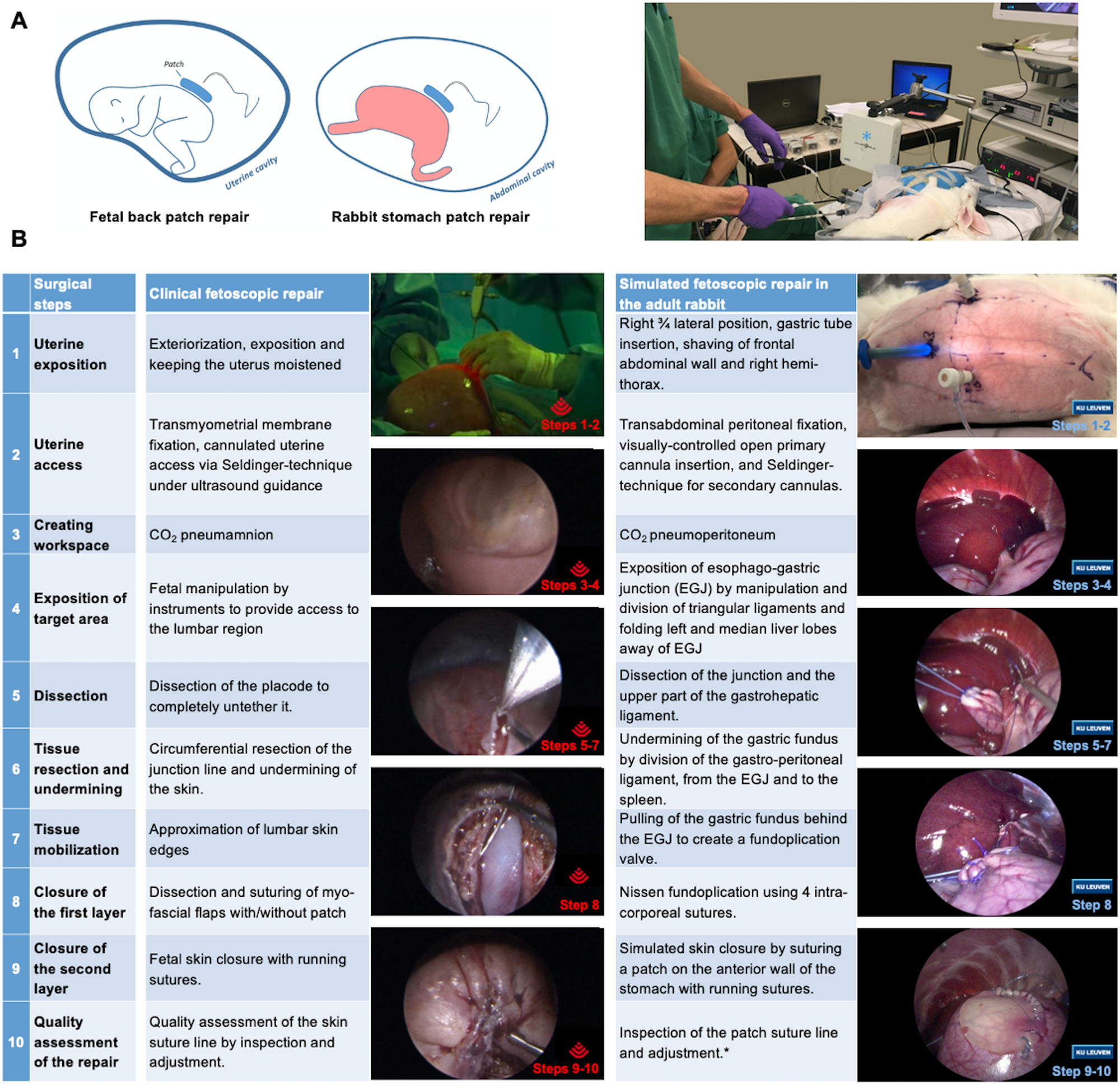 Validation of a high-fidelity training model for fetoscopic spina bifida  surgery | Scientific Reports