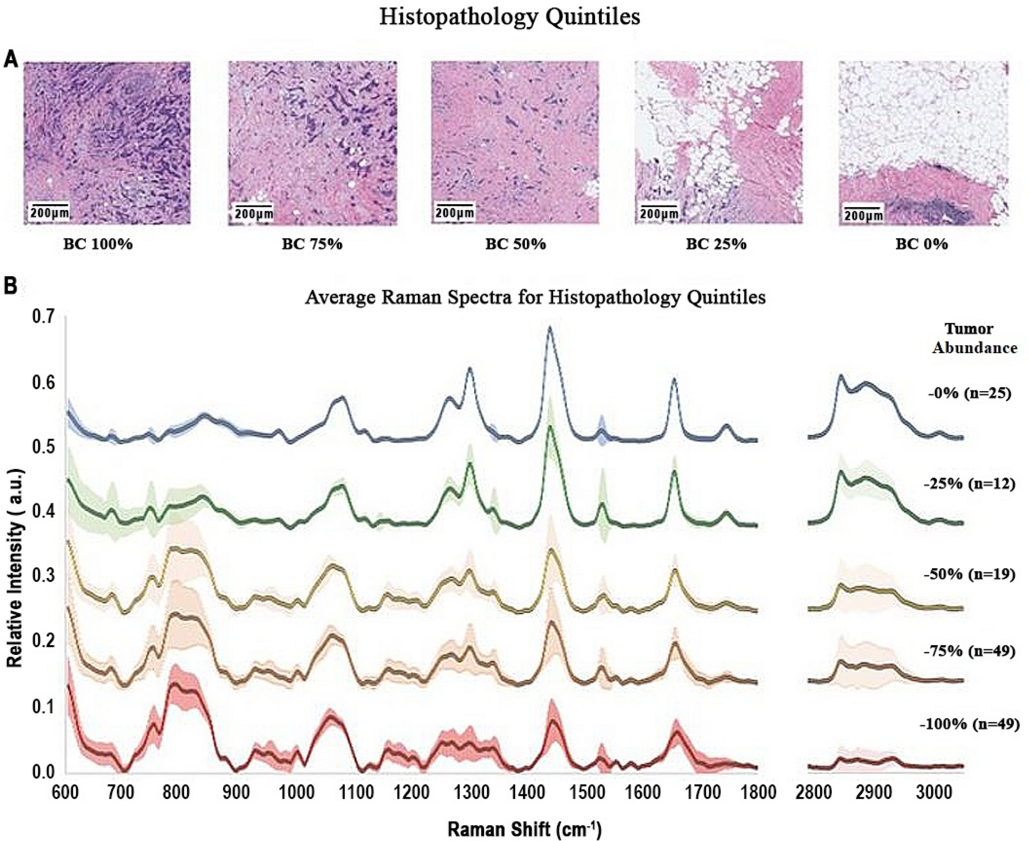 Bayesian probability of breast cancer