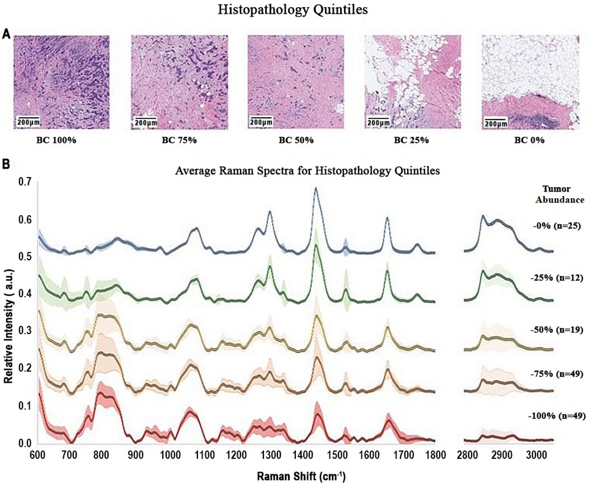 Raman spectroscopy and artificial intelligence to predict the Bayesian  probability of breast cancer | Scientific Reports