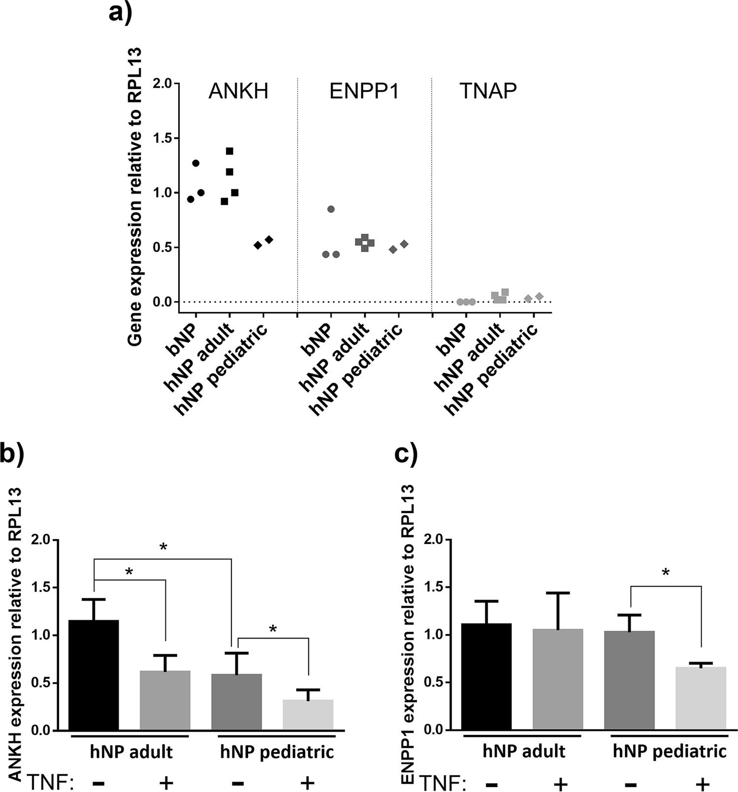 Activation of nuclear factor-kappa B by TNF promotes nucleus pulposus  mineralization through inhibition of ANKH and ENPP1 | Scientific Reports