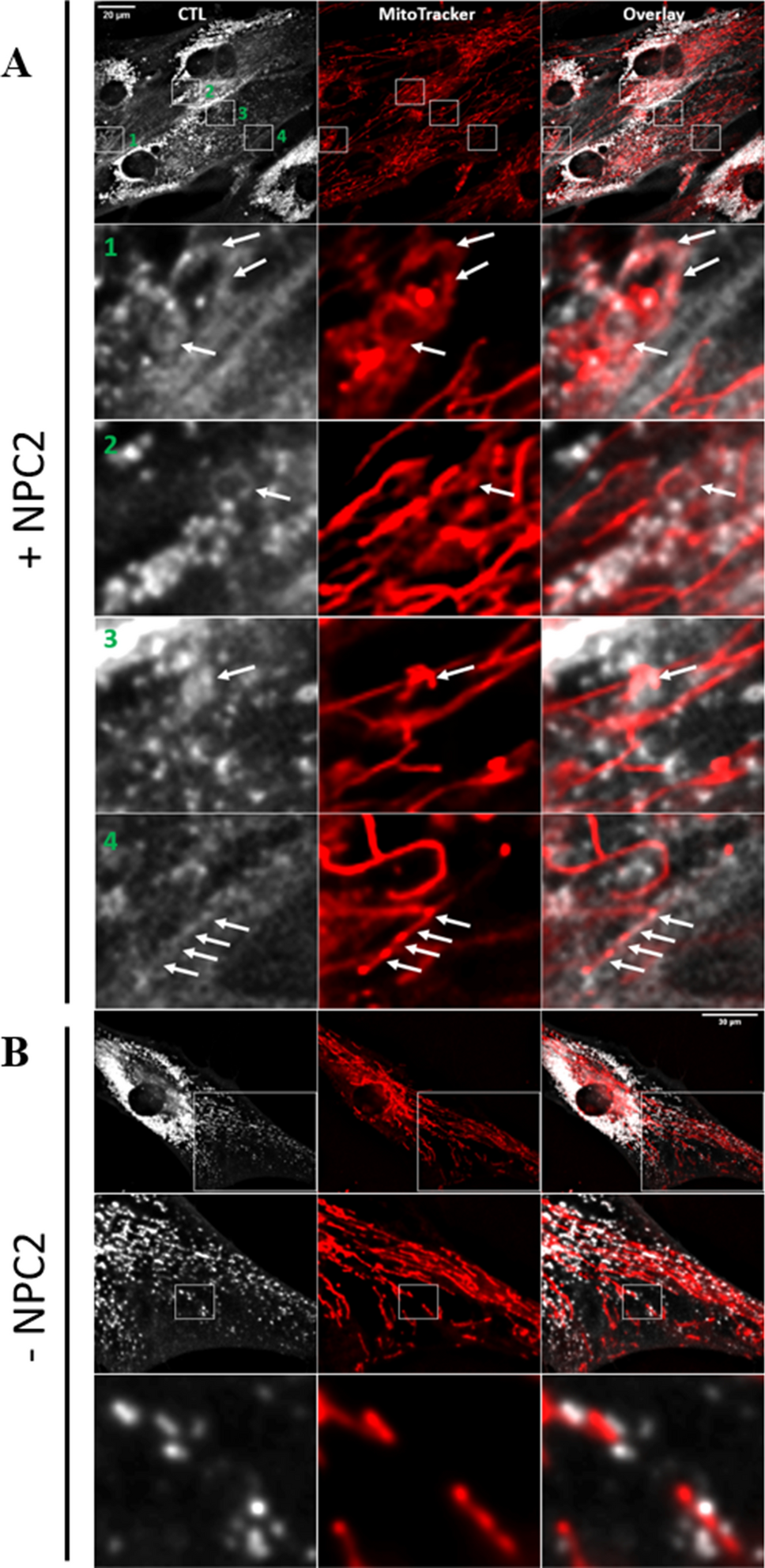 A new regulatory mechanism of STARD1 in Niemann-Pick disease type C (NPC),  discovered