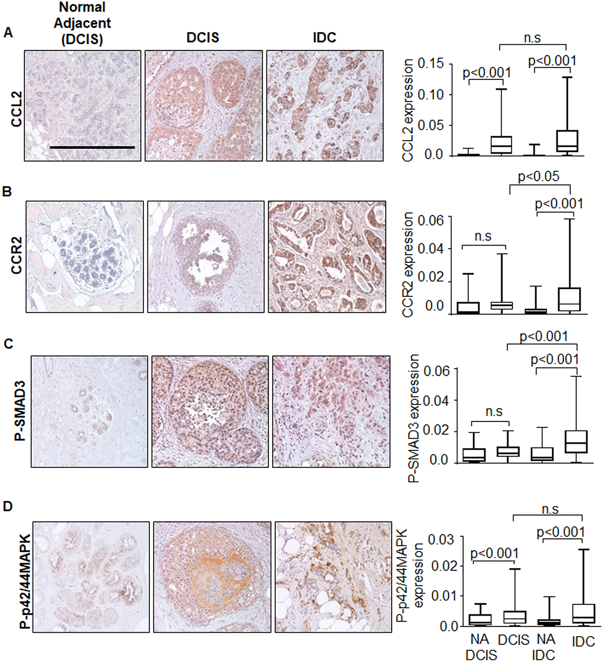 Expression of CCL2/CCR2 signaling proteins in breast carcinoma cells is  associated with invasive progression | Scientific Reports