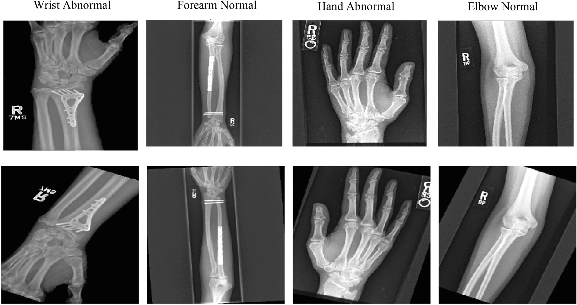 X-ray proof mewing works in adults (25+) : r/orthotropics