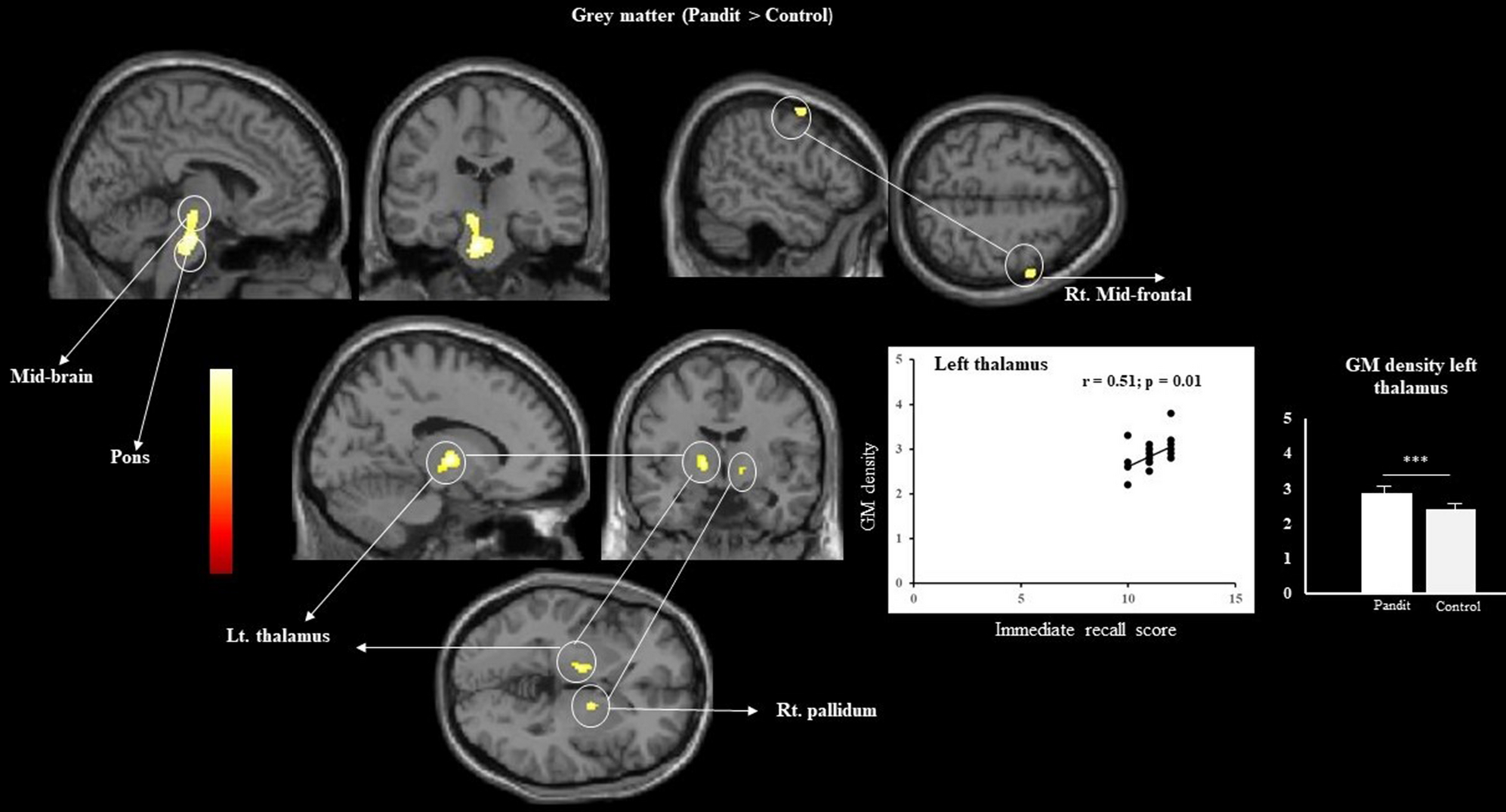 Extensive long-term verbal memory training is associated with brain  plasticity | Scientific Reports