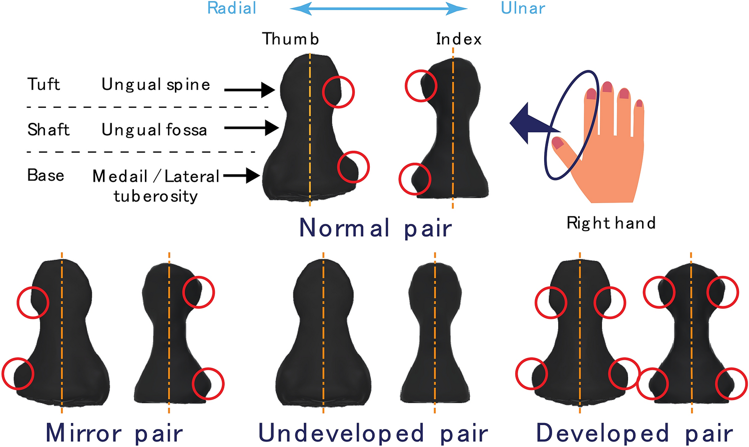 Nail Anatomy: Overview, Gross Anatomy, Nail Growth