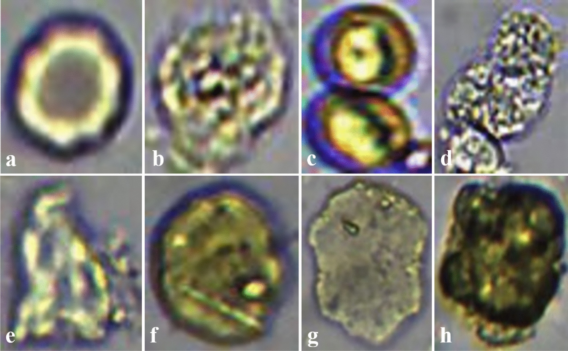 starch granules in stool