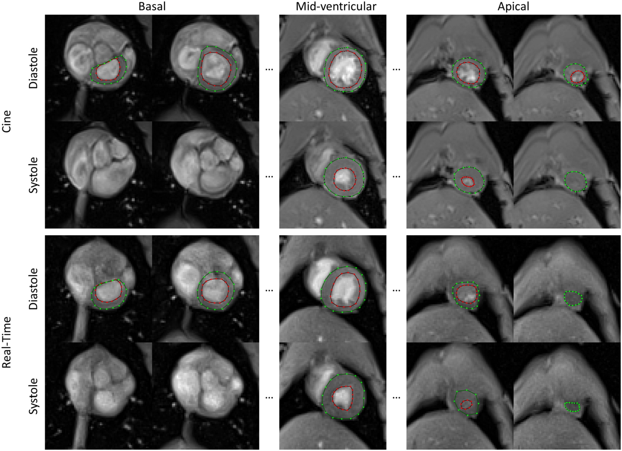 Comparison of cine and real-time cardiac MRI in rhesus macaques |  Scientific Reports