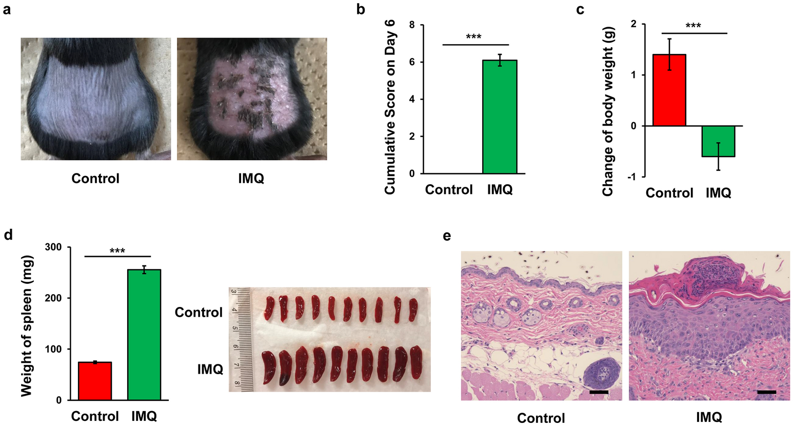 Abnormal﻿ composition of microbiota in the gut and skin of  imiquimod-treated mice | Scientific Reports