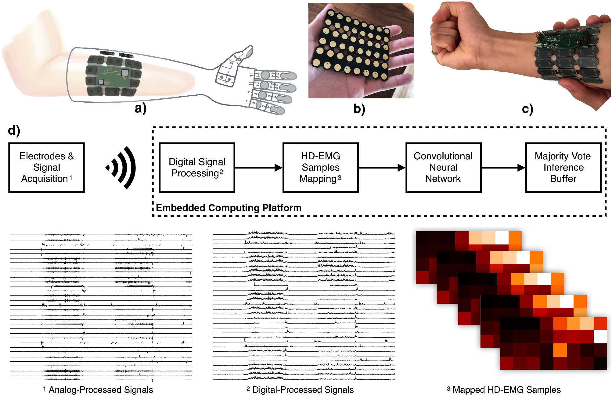 Intuitive real-time control strategy for high-density myoelectric hand  prosthesis using deep and transfer learning | Scientific Reports