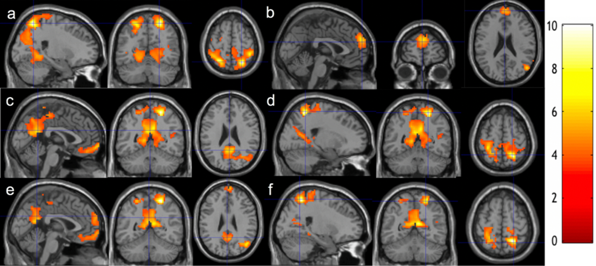 Longitudinal effects of meditation on brain resting-state functional  connectivity | Scientific Reports