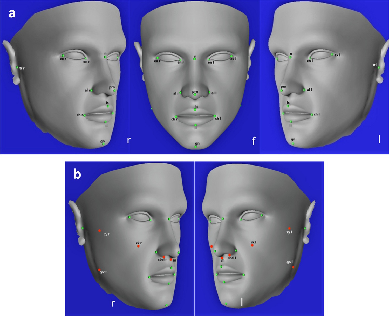 Anthropometric﻿ accuracy of three-dimensional average faces compared to  conventional facial measurements | Scientific Reports