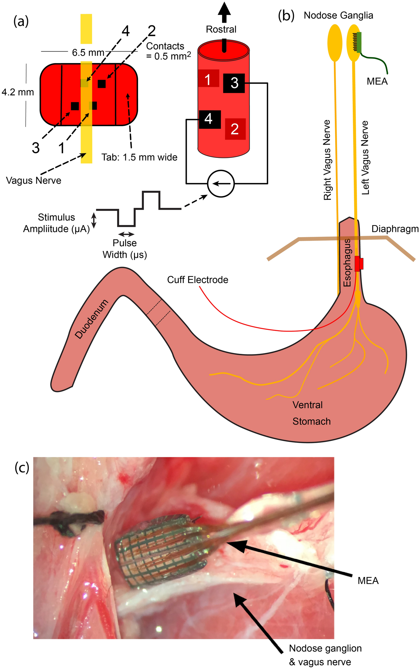 Placement of vagus nerve stimulation device. As illustrated in the