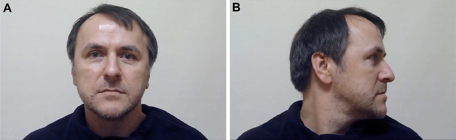 Interactive Police Line-Ups Improve Eyewitness Accuracy