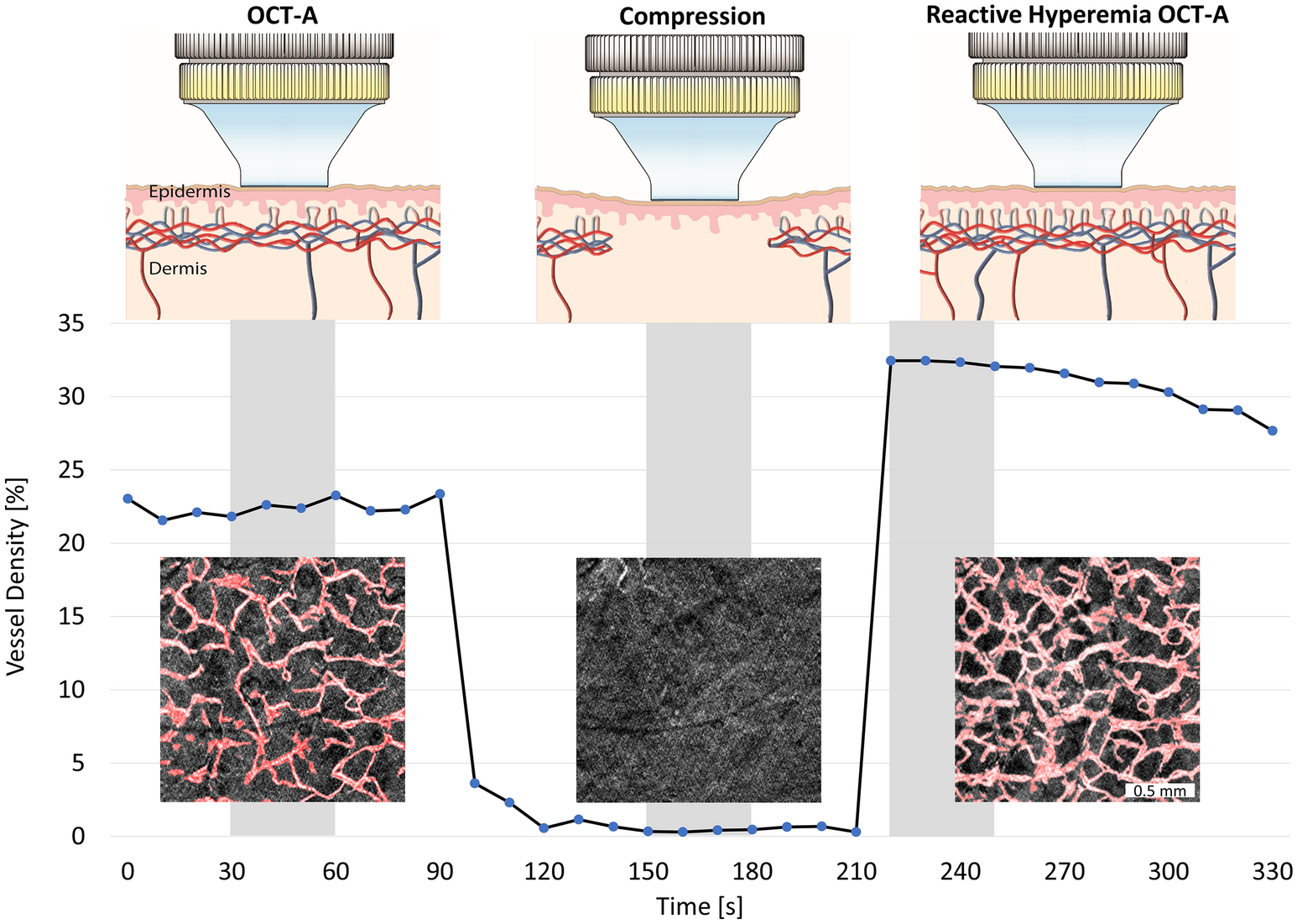 Impact of Smoking on Facial Microvessels