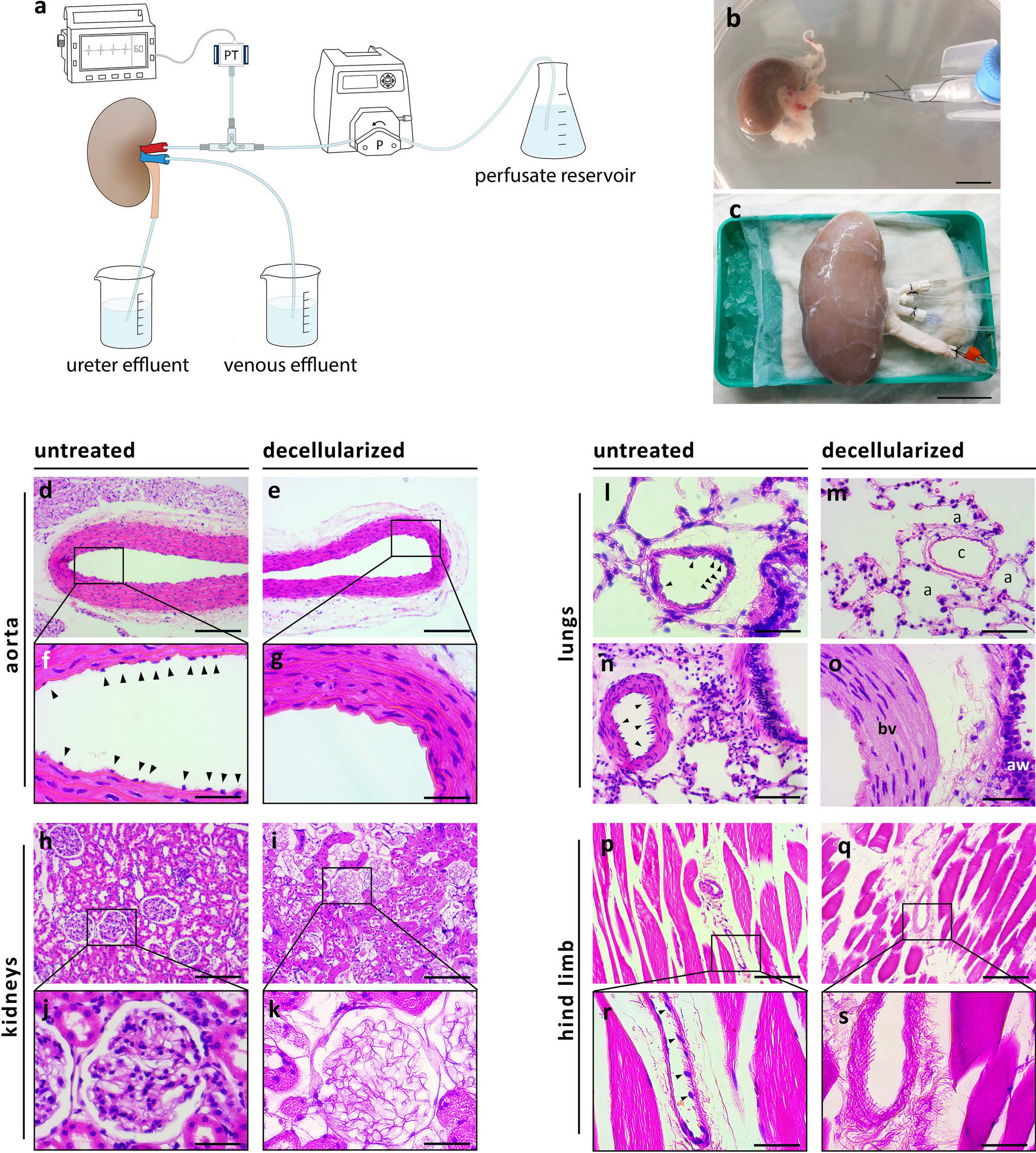 Generation of vascular chimerism within donor organs | Scientific Reports Generation of vascular chimerism within donor organs | Scientific Reports