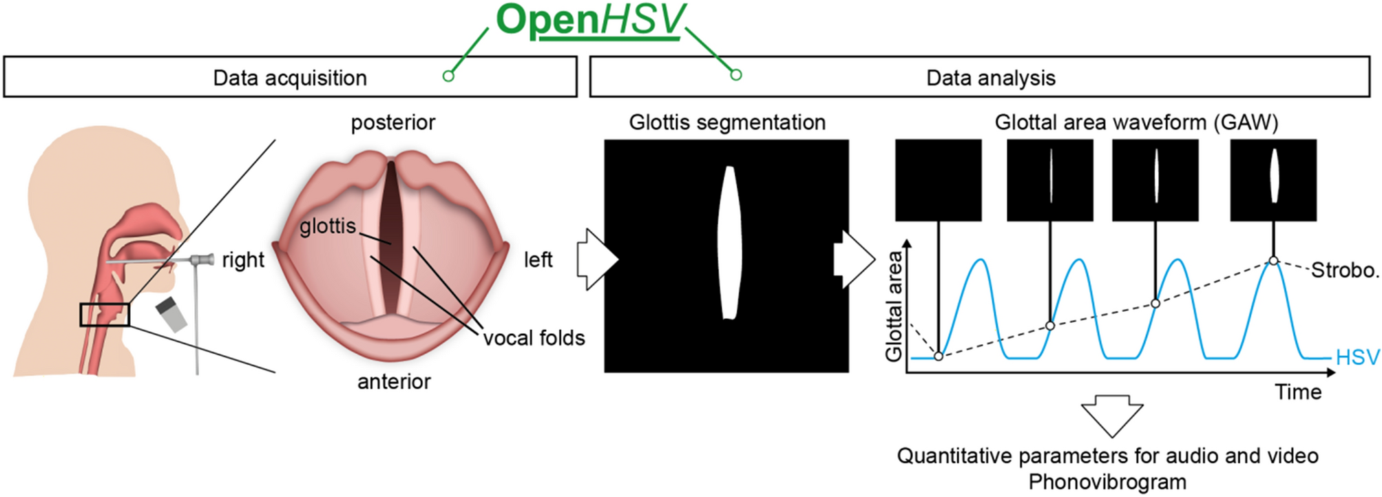 Syndicate Corresponding to Classification OpenHSV: an open platform for laryngeal high-speed videoendoscopy |  Scientific Reports