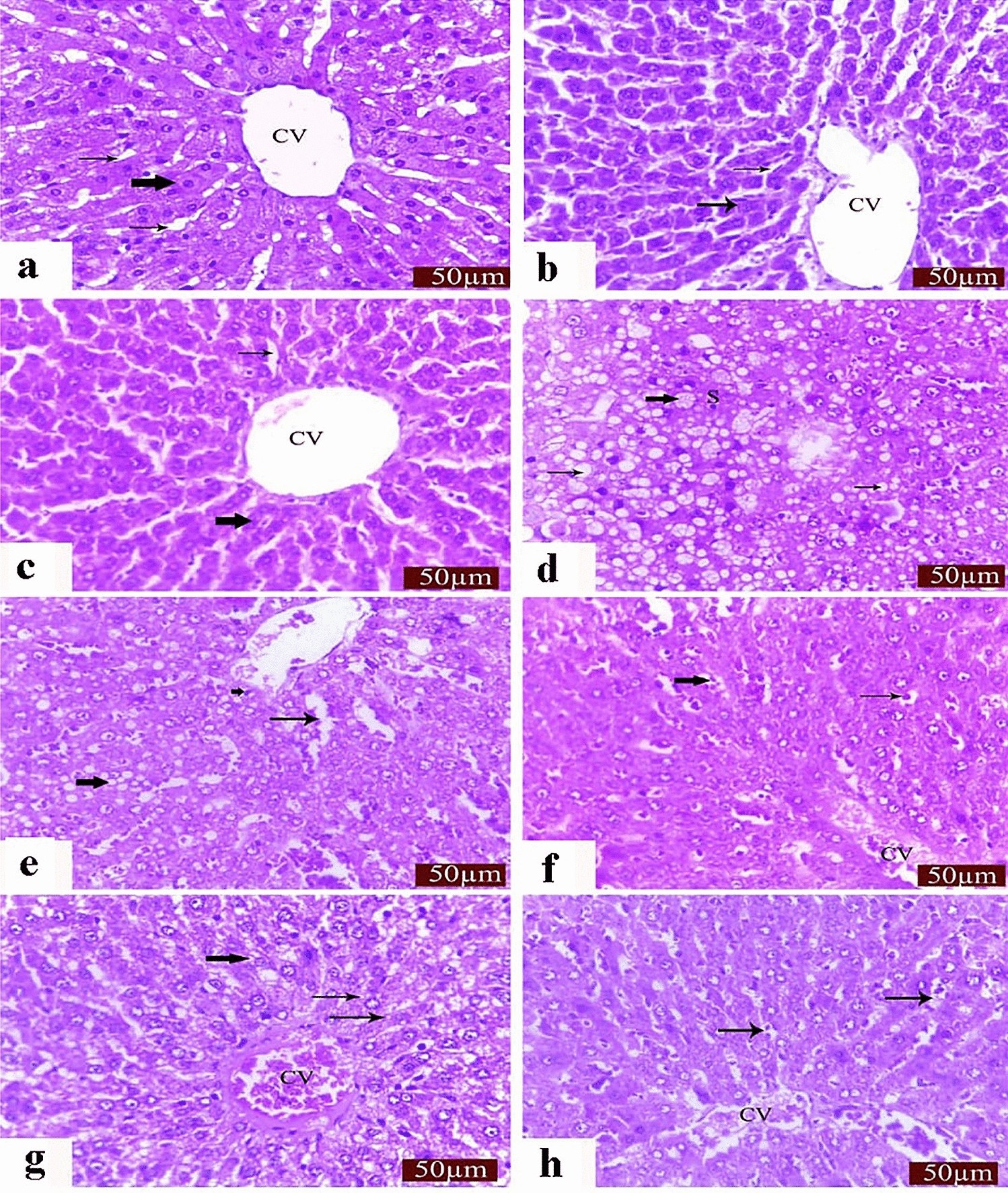 glutathione with lycopene side effects Synergistic protective of and N-acetylcysteine against cisplatin-induced hepatorenal toxicity in rats Shop by Category