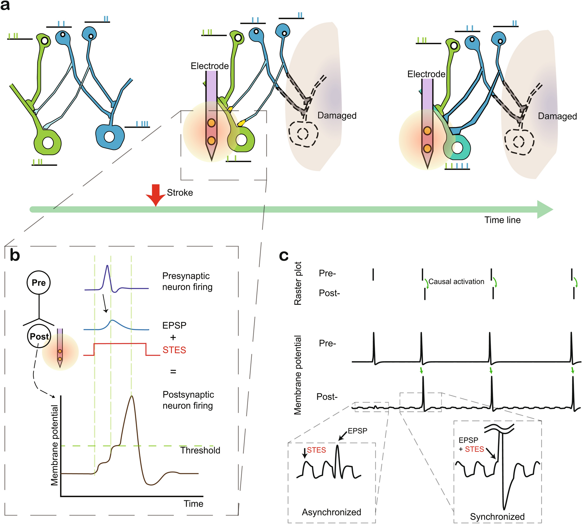 Study: Electrical stimulation shown to be effective in treating