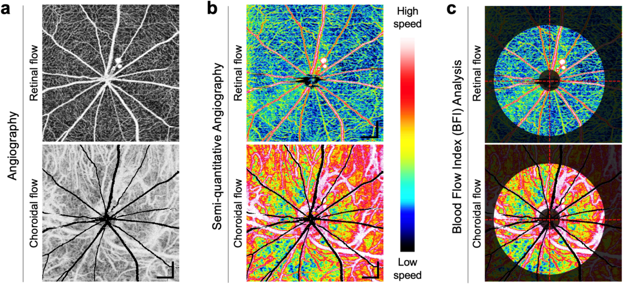 Retinal Variables - Info Visualization