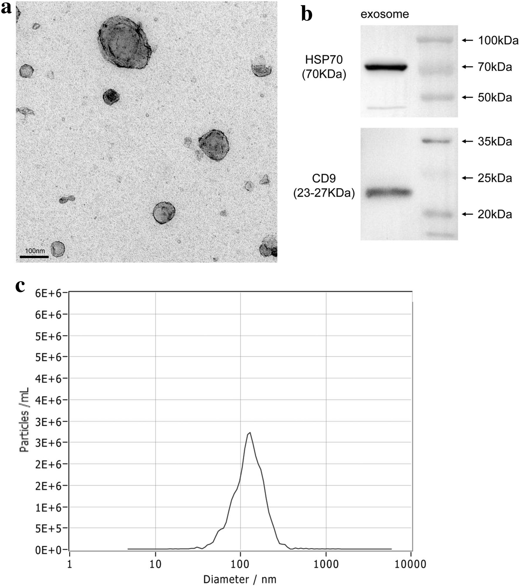 Mesenchymal stem cell-derived exosomes protect trabecular meshwork from  oxidative stress | Scientific Reports