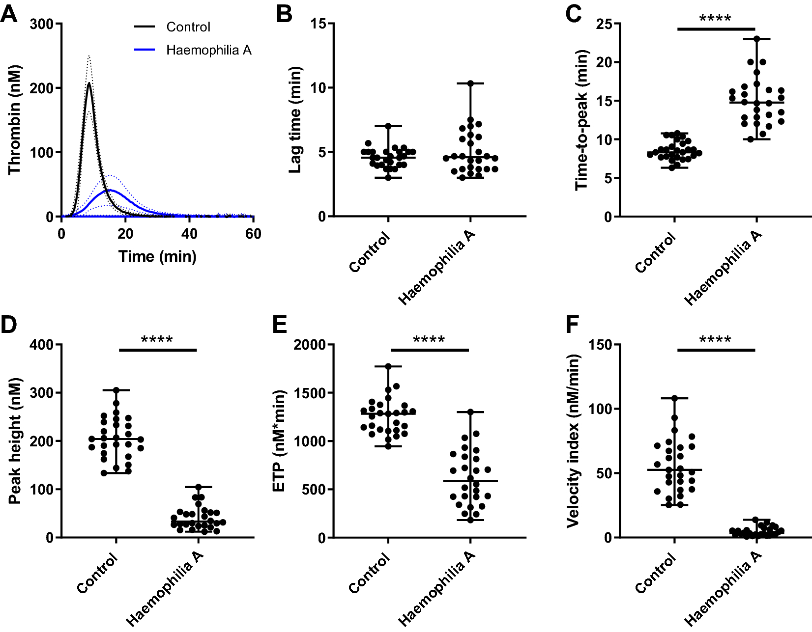 Antithrombin-lowering in hemophilia: a closer look at fitusiran