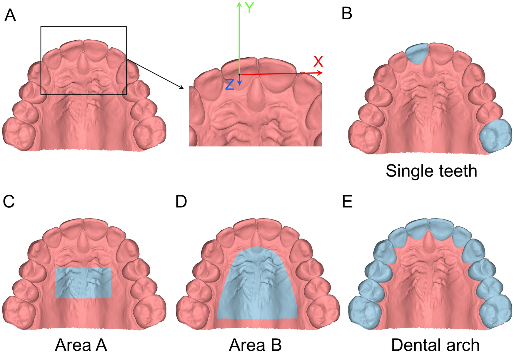 Intraoral scanners for capturing the palate and its relation to the  dentition | Scientific Reports