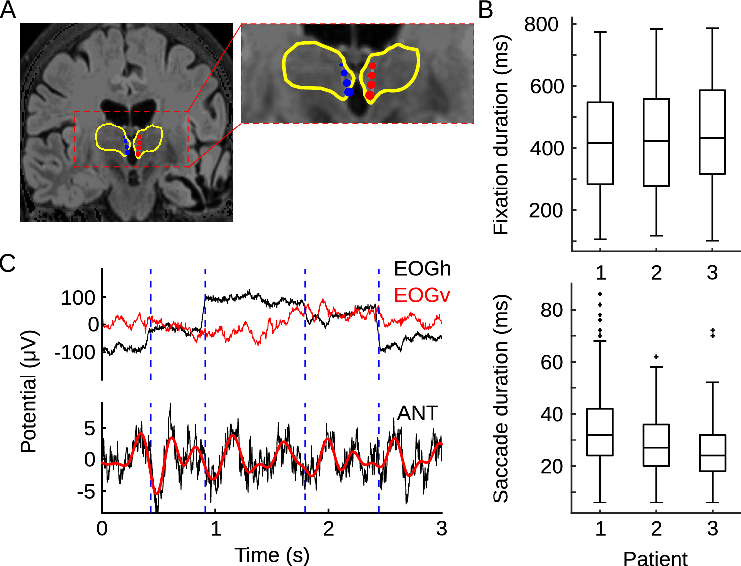 Neural Activity In The Human Anterior Thalamus During Natural Vision Scientific Reports Neural Activity In The Human Anterior Thalamus During Natural Vision Scientific Reports