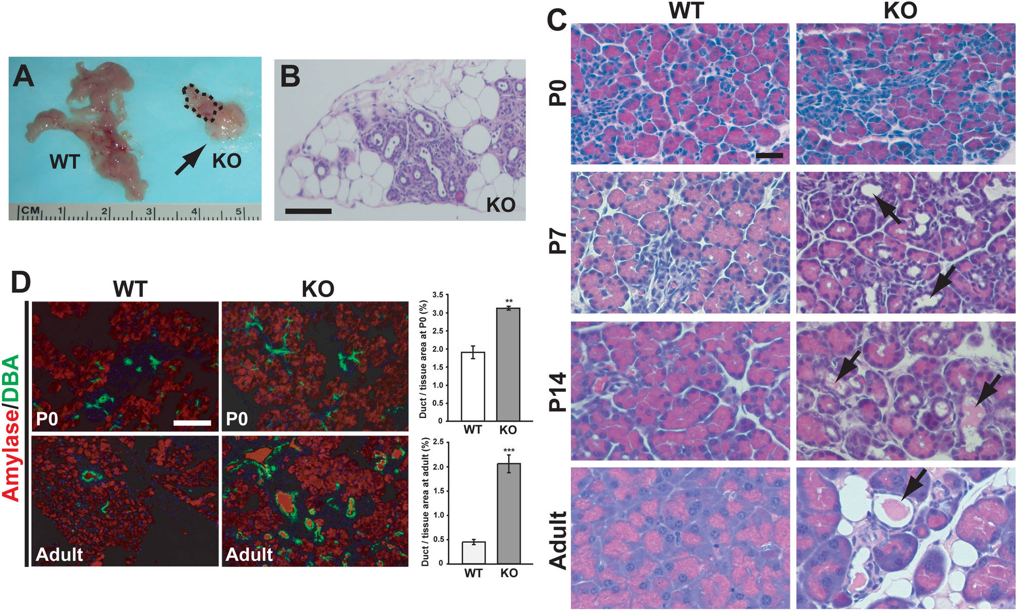 Loss Of The Ciliary Protein Chibby1 In Mice Leads To Exocrine Pancreatic Degeneration And Pancreatitis Scientific Reports
