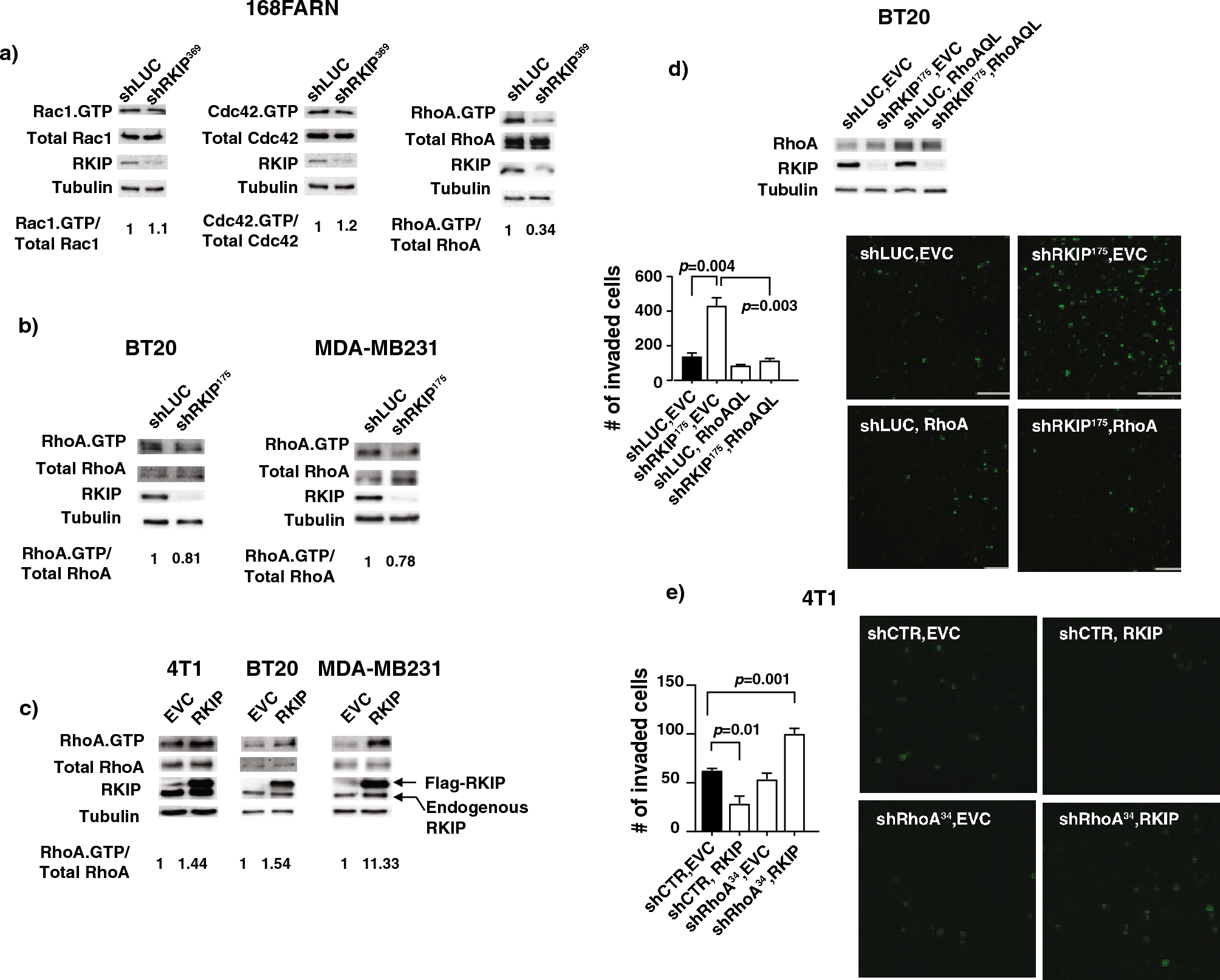 The RhoA dependent anti-metastatic function of RKIP in breast cancer |  Scientific Reports