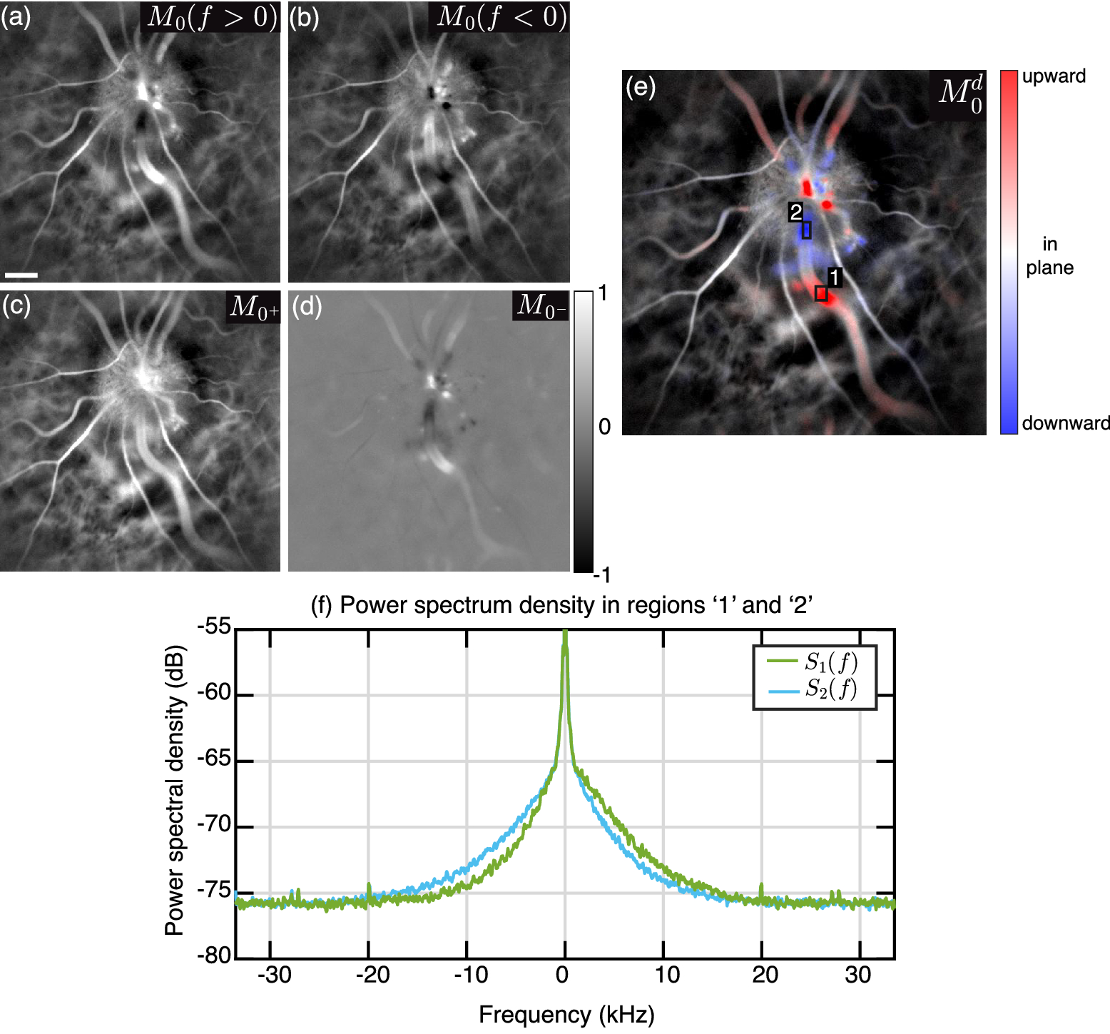 Retinal Blood Flow Reversal Quantitatively Monitored In Out Of Plane Vessels With Laser Doppler Holography Scientific Reports