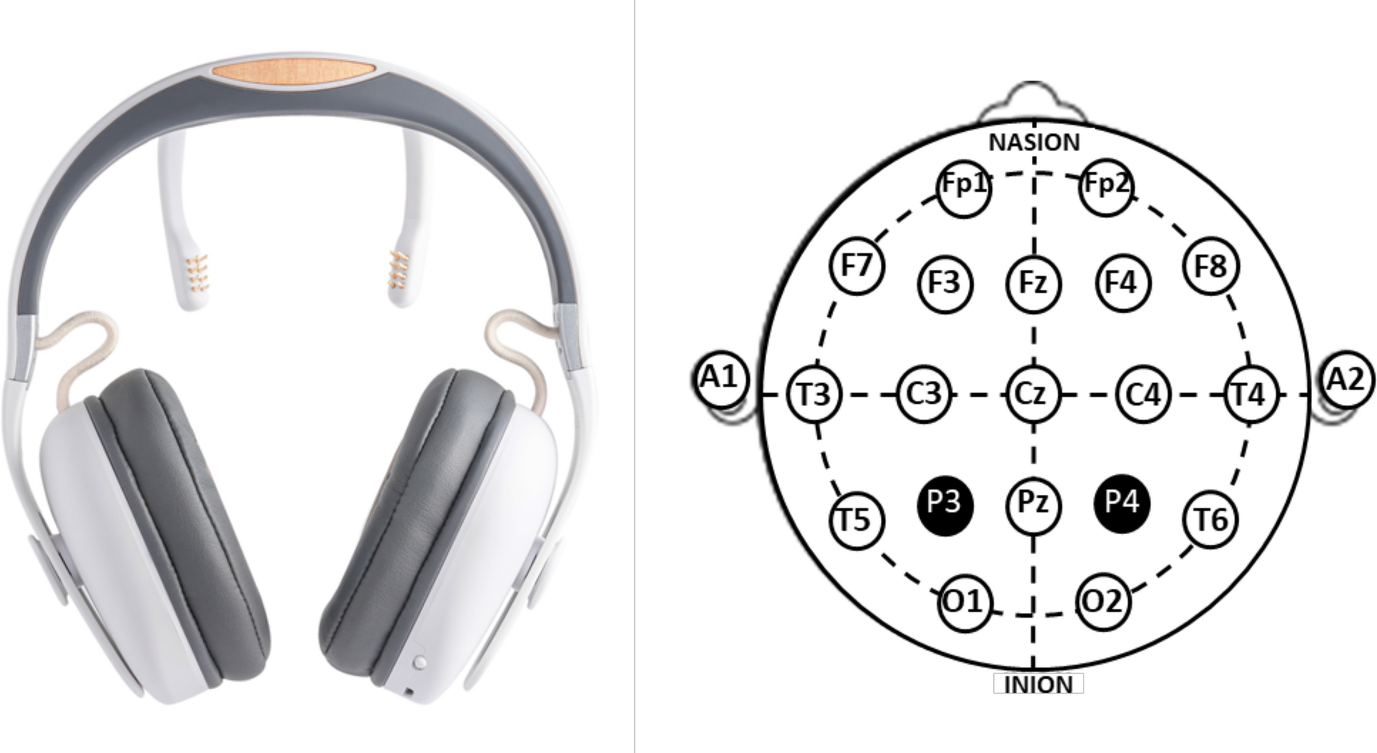 Alpha activity neuromodulation induced by individual alpha-based  neurofeedback learning in ecological context: a double-blind randomized  study | Scientific Reports