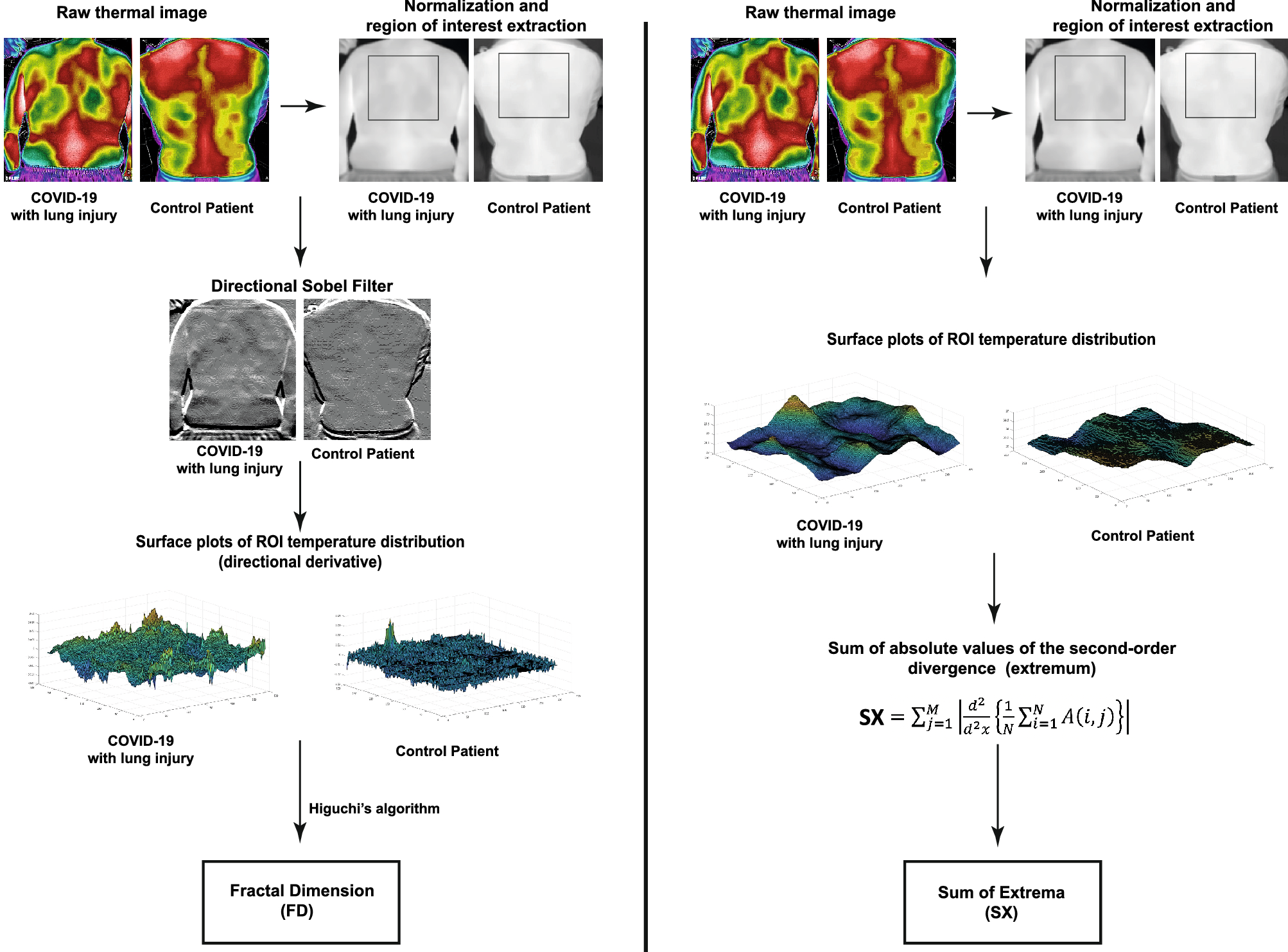 Automated Processing Of Thermal Imaging To Detect Covid 19 Scientific Reports