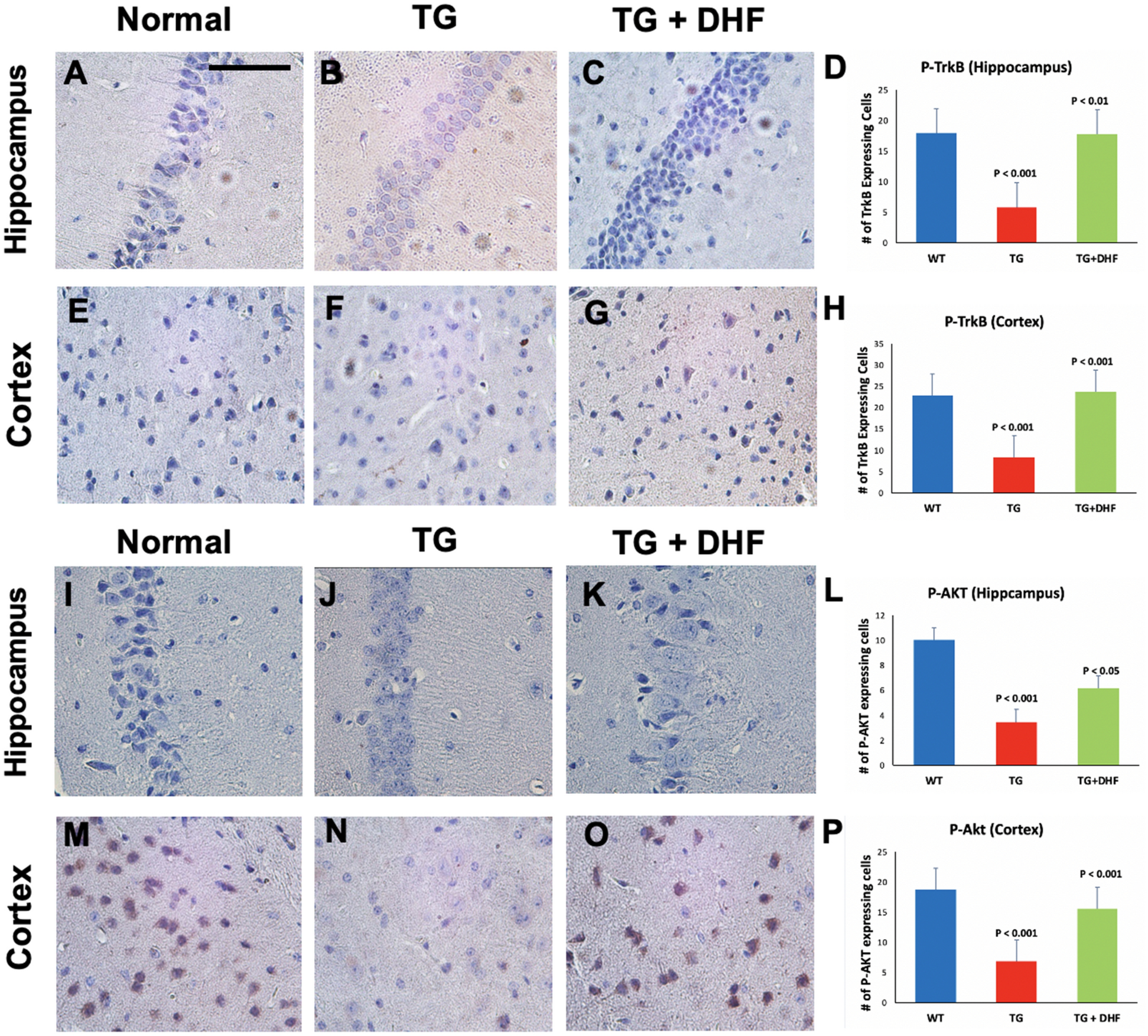 7,8-Dihydroxyflavone improves neuropathological changes in the brain of  Tg26 mice, a model for HIV-associated neurocognitive disorder | Scientific  Reports