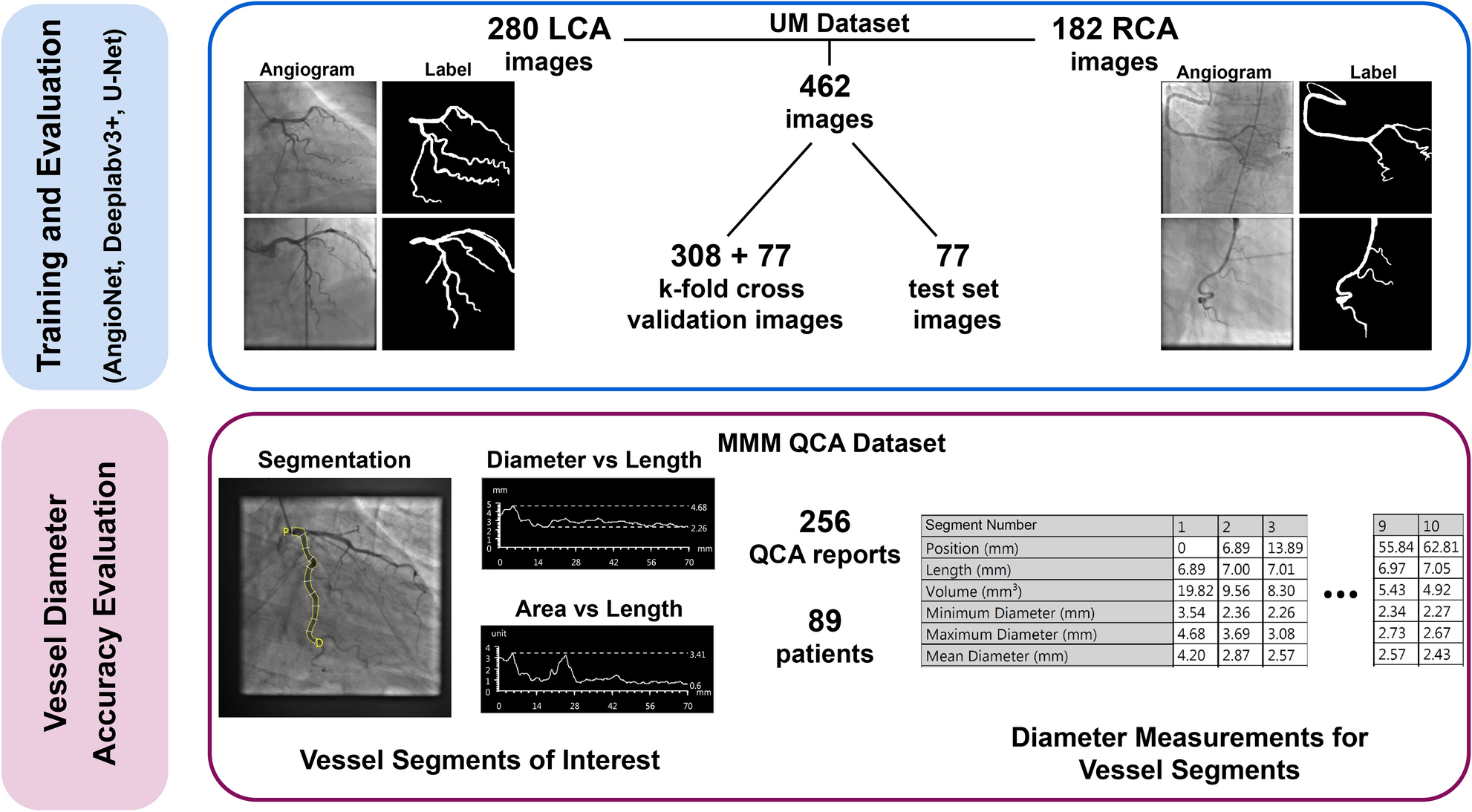 Angionet A Convolutional Neural Network For Vessel Segmentation In X Ray Angiography Scientific Reports