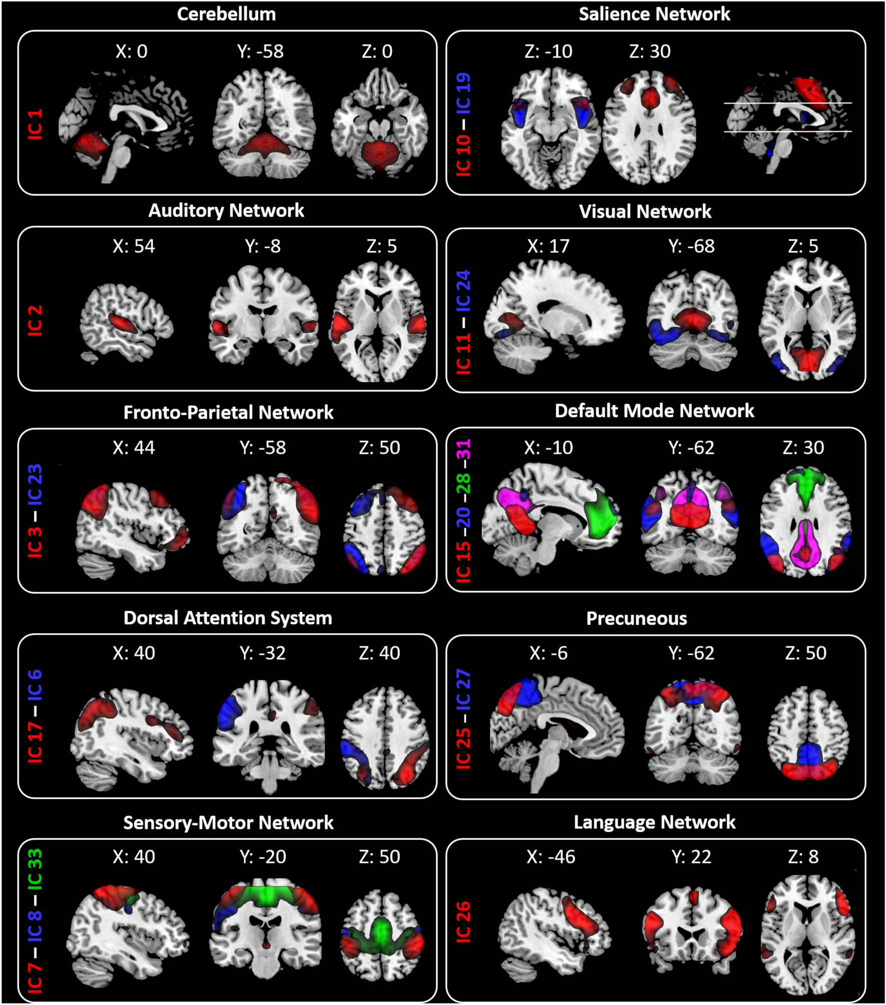 Hypothalamic structural integrity and temporal complexity of cortical  information processing at rest in migraine without aura patients between  attacks | Scientific Reports