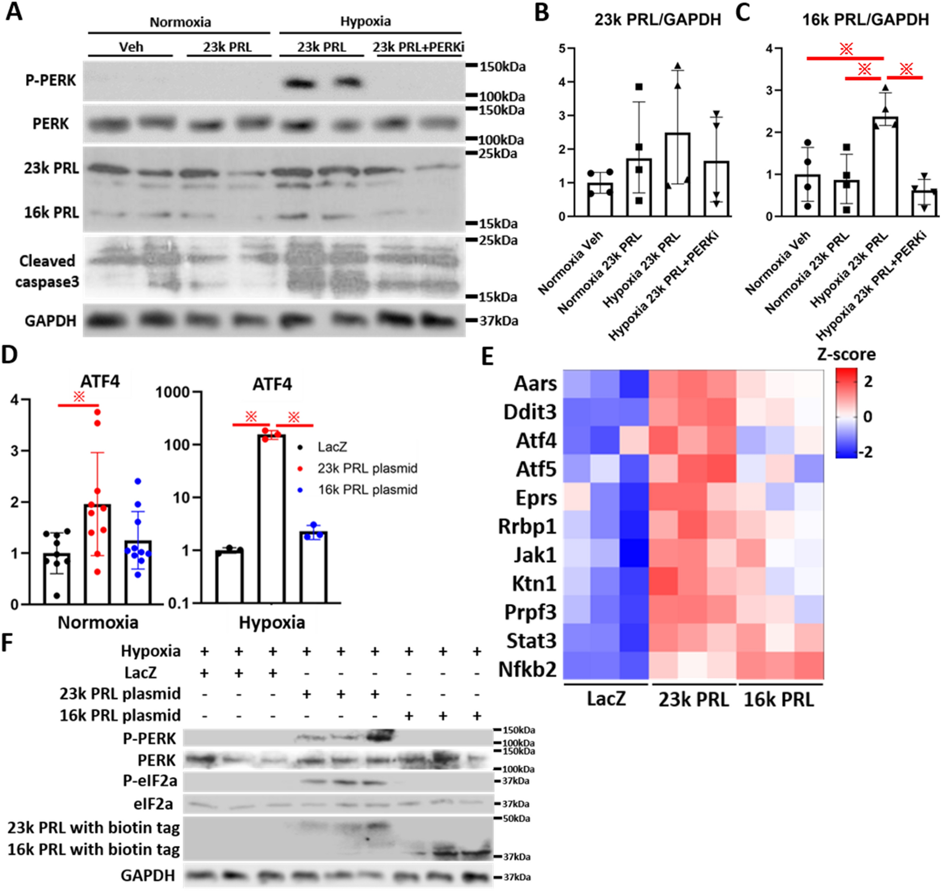inhibition of cardiac perk signaling promotes peripartum cardiac dysfunction scientific reports