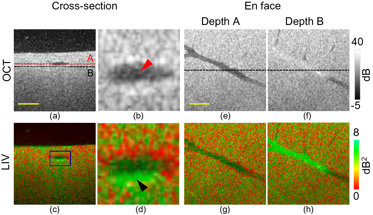 Automated liver tissues delineation techniques: A systematic