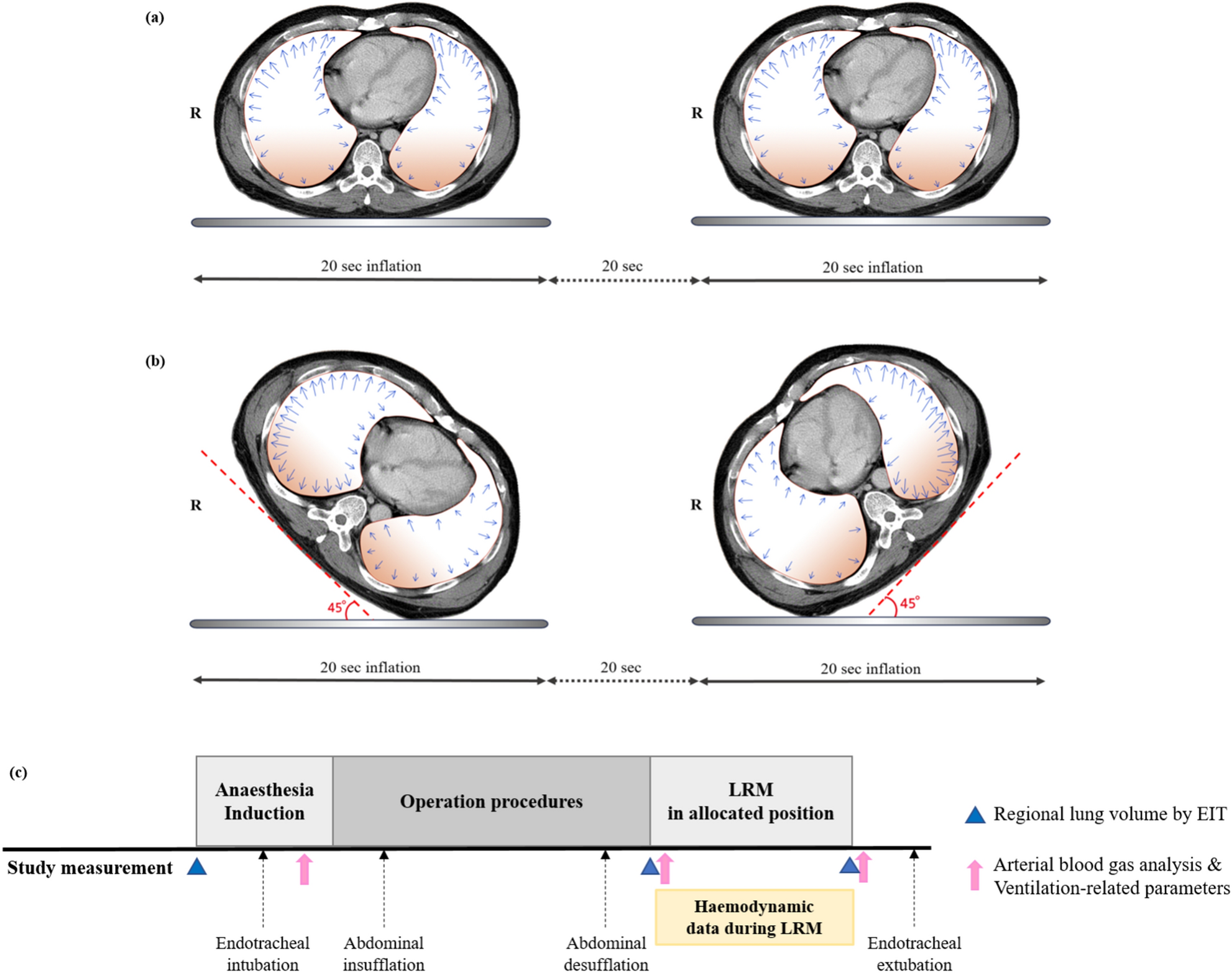 Benefits of prone positioning for mechanically ventilated patients 